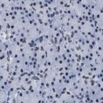 DBC1 Antibody in Immunohistochemistry (IHC)