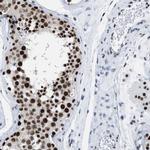 DBC1 Antibody in Immunohistochemistry (IHC)