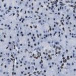 DBC1 Antibody in Immunohistochemistry (IHC)