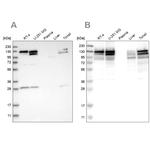 DBC1 Antibody in Western Blot (WB)