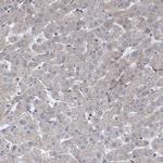 ABCF2 Antibody in Immunohistochemistry (IHC)