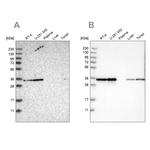 PPA1 Antibody in Western Blot (WB)