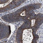 MACC1 Antibody in Immunohistochemistry (IHC)