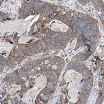 MACC1 Antibody in Immunohistochemistry (IHC)