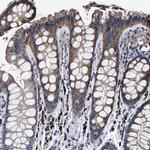 MACC1 Antibody in Immunohistochemistry (IHC)