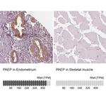 PAEP Antibody in Immunohistochemistry (IHC)