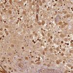 PAEP Antibody in Immunohistochemistry (IHC)