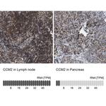 CCM2 Antibody in Immunohistochemistry (IHC)
