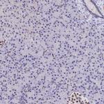 BCL9 Antibody in Immunohistochemistry (IHC)