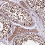 ZBTB39 Antibody in Immunohistochemistry (IHC)