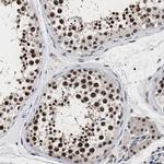 RRP1B Antibody in Immunohistochemistry (IHC)