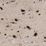 LARP6 Antibody in Immunohistochemistry (IHC)