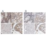 Ataxin 2 Antibody in Immunohistochemistry (IHC)