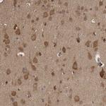 Ataxin 2 Antibody in Immunohistochemistry (IHC)