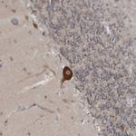 Ataxin 2 Antibody in Immunohistochemistry (IHC)