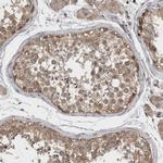 Ataxin 2 Antibody in Immunohistochemistry (IHC)