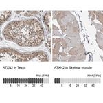 Ataxin 2 Antibody