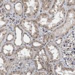 CLIP2 Antibody in Immunohistochemistry (IHC)