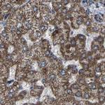 NDUFV3 Antibody in Immunohistochemistry (IHC)