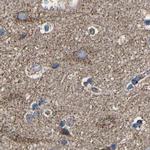 NDUFV3 Antibody in Immunohistochemistry (IHC)