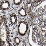 NDUFV3 Antibody in Immunohistochemistry (IHC)