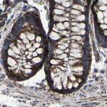 NDUFV3 Antibody in Immunohistochemistry (IHC)