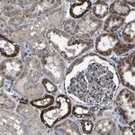 NDUFV3 Antibody in Immunohistochemistry (IHC)