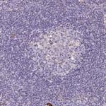 SCIN Antibody in Immunohistochemistry (IHC)