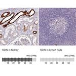 SCIN Antibody