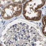 SHMT2 Antibody in Immunohistochemistry (IHC)