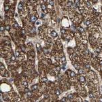 SHMT2 Antibody in Immunohistochemistry (IHC)