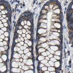 SHMT2 Antibody in Immunohistochemistry (IHC)