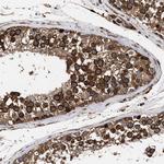 SERBP1 Antibody in Immunohistochemistry (IHC)