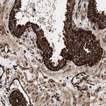 SERBP1 Antibody in Immunohistochemistry (IHC)