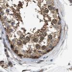 BAG3 Antibody in Immunohistochemistry (IHC)