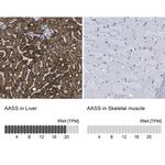 AASS Antibody in Immunohistochemistry (IHC)