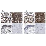 AASS Antibody in Immunohistochemistry (IHC)