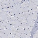 AASS Antibody in Immunohistochemistry (IHC)