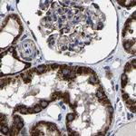 AASS Antibody in Immunohistochemistry (IHC)