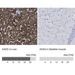 AASS Antibody