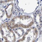 AASS Antibody in Immunohistochemistry (IHC)