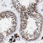 SQLE Antibody in Immunohistochemistry (IHC)