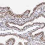 ZMYND8 Antibody in Immunohistochemistry (IHC)