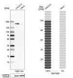 ZMYND8 Antibody in Western Blot (WB)