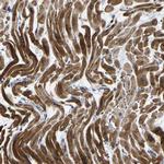 AGK Antibody in Immunohistochemistry (IHC)