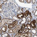 AGK Antibody in Immunohistochemistry (IHC)