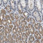 AGK Antibody in Immunohistochemistry (IHC)