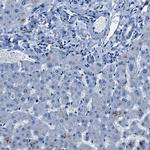 NACAD Antibody in Immunohistochemistry (IHC)