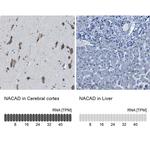 NACAD Antibody