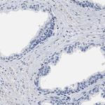 ZFAT Antibody in Immunohistochemistry (IHC)